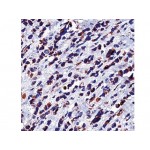 Heat Shock Protein 60 , LK1 , IgG1 - 0.5ml
