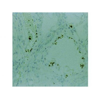 Thrombospondin , A6.1 , IgG1 - 0.5ml