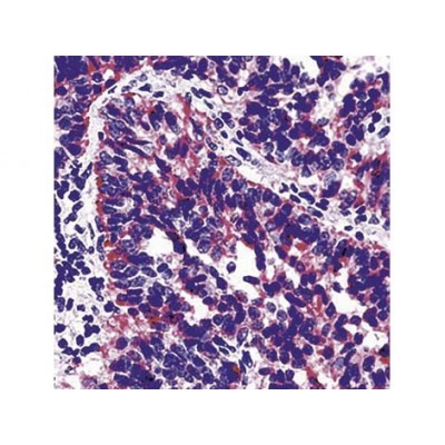 Monoclonal Mouse Antibody toTIMP-2 , 3A4 , IgG2a - 0.5ml