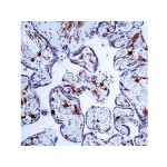 Factor XIIIa , AC-1A1 , IgG1 - 1ml