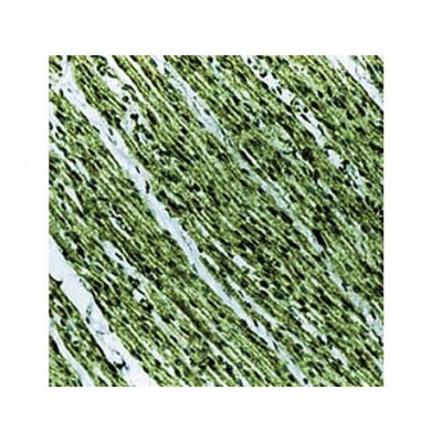 Prohibitin , II-14-10 , IgG1 - 0.5ml Prohibitin , II-14-10 , IgG1 - 0.5ml