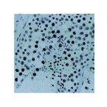 Monoclonal Mouse Antibody toXRCC1 , 33-2-5 , IgG2b - 0.5ml