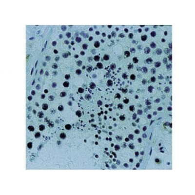 Monoclonal Mouse Antibody toXRCC1 , 33-2-5 , IgG2b - 0.5ml