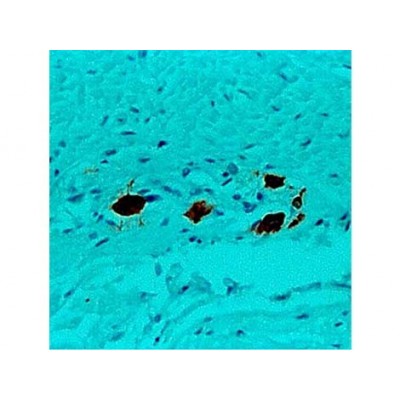 Ret Oncoprotein , RET01 (same as 3F8) , IgG1 - 1ml