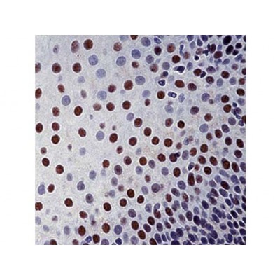 Monoclonal Mouse Antibody toXPA , 12F5 , IgG2a - 0.5ml