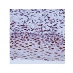 ERCC1 , 8F1 , IgG2b - 1ml