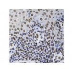 Monoclonal Mouse AntibCDC25A , DCS-120 , IgG2a+IgG2a - 0.5ml