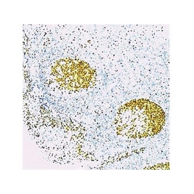 CDC47 , 47DC141 , IgG1 - 1ml