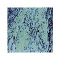 Mast Cell Chymase , CC1 , IgG1 - 1ml Mast Cell Chymase , CC1 , IgG1 - 1ml