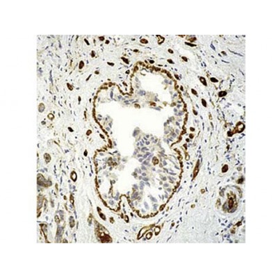 Transglutaminase II , CUB7402 , IgG1 - 1ml