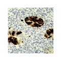 Monoclonal Mouse AAdenovirus , M58+M73 , IgG2a+IgG2a - 0.5ml
