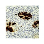 Monoclonal Mouse AAdenovirus , M58+M73 , IgG2a+IgG2a - 0.5ml