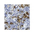 CD15, Granulocyte Assoc. Antigen , MMA , IgM - 0.5ml