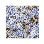 CD15, Granulocyte Assoc. Antigen , MMA , IgM - 0.5ml
