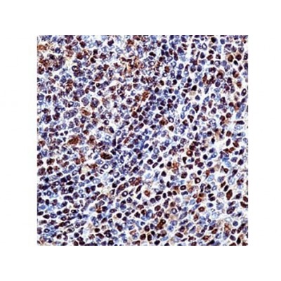 p130 , 130P215 , IgG1 - 1ml