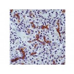 CFTR , M3A7 , IgG1 - 1ml