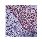 E2F-1 Transcription Factor , KH95 , IgG2a - 0.5ml