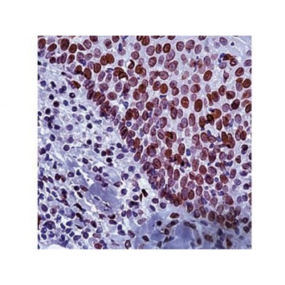 E2F-1 Transcription Factor , KH95 , IgG2a - 0.5ml