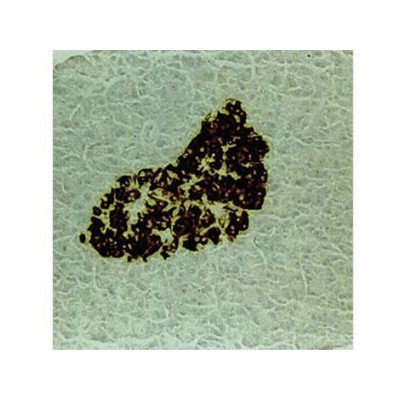 Insulin , E2E3 , IgG1 - 1ml Insulin , E2E3 , IgG1 - 1ml