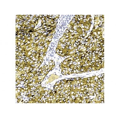 Melanoma Pan , Cocktail , IgG - 0.5ml