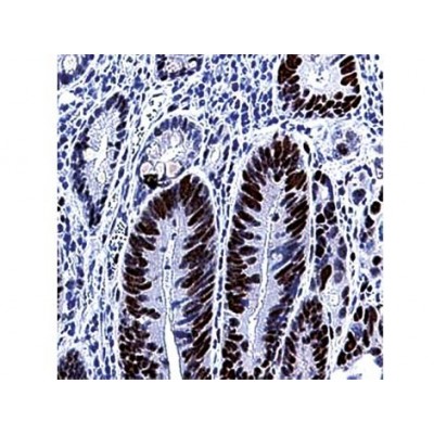 MSH6 , 44 , IgG1 - 0.5ml MSH6 , 44 , IgG1 - 0.5ml
