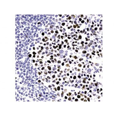 MLH-1 , G168-15 , IgG1 - 1ml