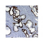 Cytokeratin 5&14 , XM26&LL002 , IgG1&IgG3 - 0.5ml