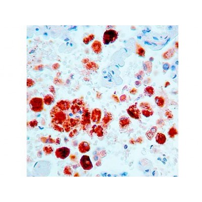 Napsin A , KCG1.1 , IgG1 - 1ml