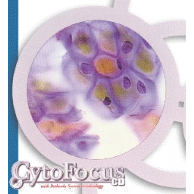 CYTOFOCUS CD - PC VERSION UK - 1 USER