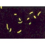 Auramine/Phenol (Lempert) - 1L