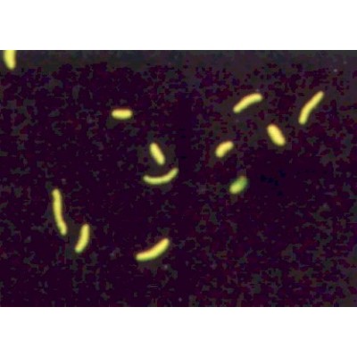 Auramine/Phenol 10 x conc. - 100ML