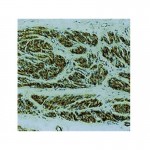 Actin , HHF35 , IgG1 - 6ml