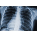 X-Ray Imaging