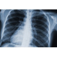 X-Ray Imaging X-Ray Imaging