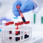Haematology