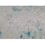 Auramine Permanganate 0.1% Aqueous - 1L