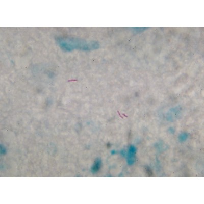 Auramine Permanganate 0.1% Aqueous - 1L Auramine Permanganate 0.1% Aqueous - 1L